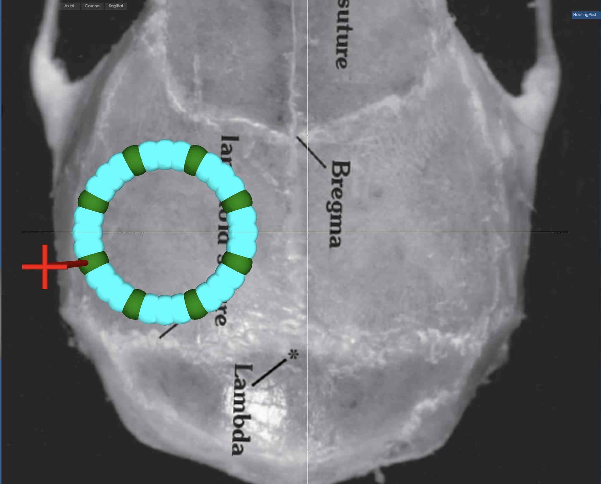 Cranial Window